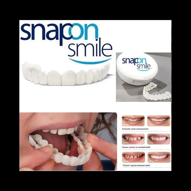 Silicone Snap-On Smile Teeth Decoration Kit  Safe & Eco-Friendly Imitation Braces for a Confident Smile
